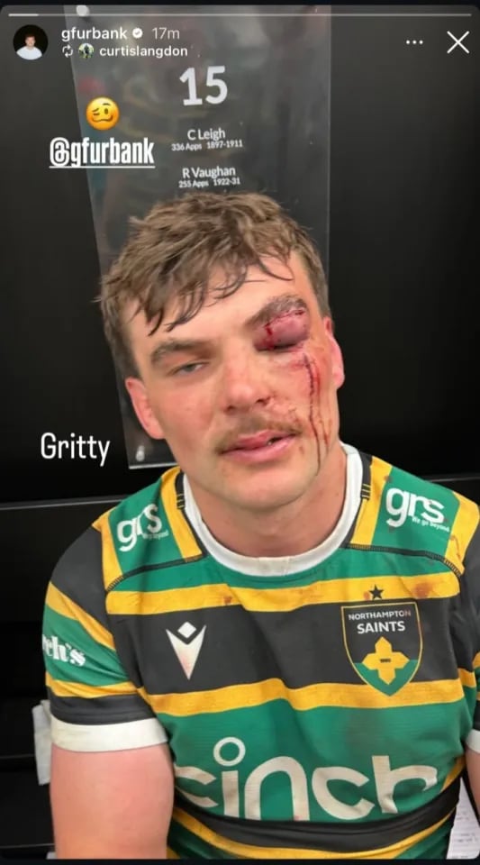 La imagen que compartió George Furbank tras el partido