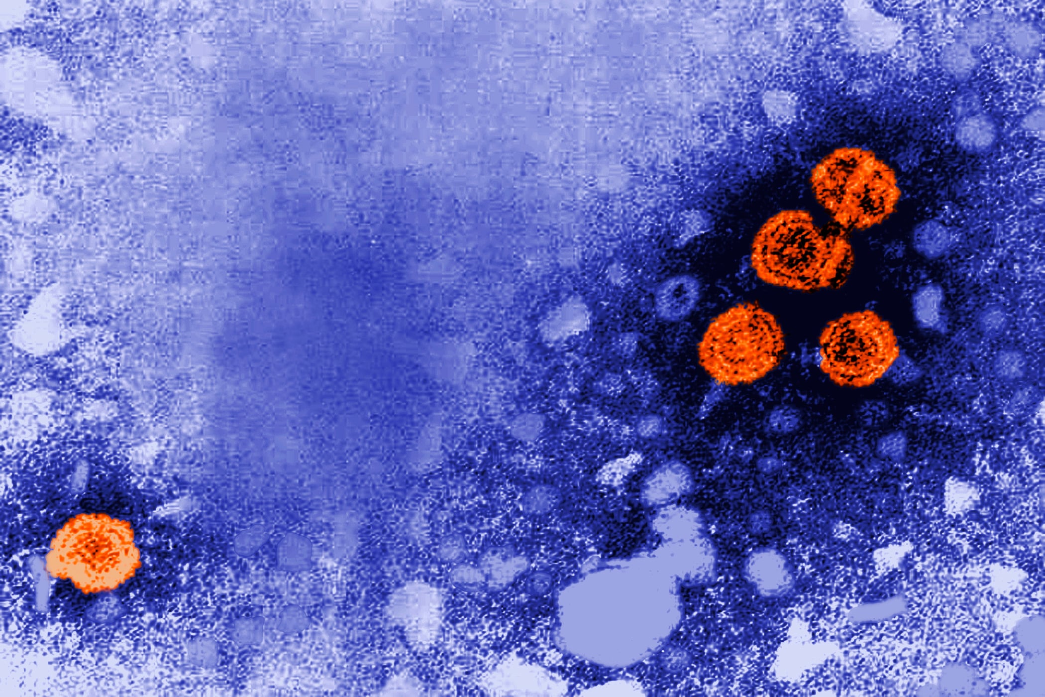 El monitoreo de aguas residuales en el AMBA permitió detectar hepatitis A y E, reforzando la vigilancia epidemiológica en Argentina. (Dr. Erskine Palmer/CDC via AP, Archivo)
