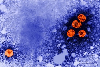 El monitoreo de aguas residuales en el AMBA permitió detectar hepatitis A y E, reforzando la vigilancia epidemiológica en Argentina. (Dr. Erskine Palmer/CDC via AP, Archivo)