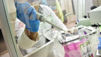 La Universidad de El Salvador identifica dos genotipos del virus Epstein-Barr en linfomas de Hodgkin