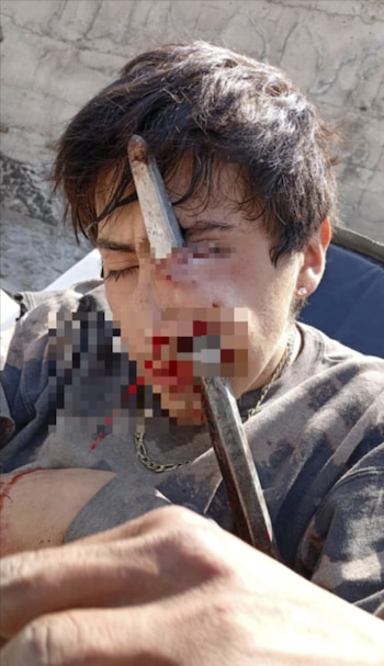 El joven habría tropezado incrstándosele