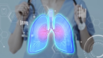 Las nuevas tecnologías hacen que el diagnóstico y tratamiento del cáncer de pulmón sean más rápidos y seguros