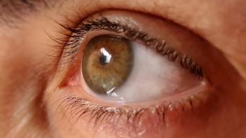 Glaucoma: por qué es clave