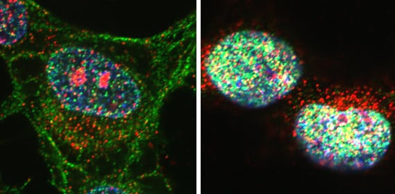 Células cancerosas HeLa, antes y después de la terapia con esteroides (Instituto Weizmann)