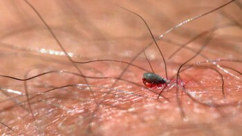 Una familia murió por ricketssia