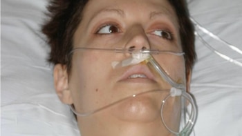 El abrigo de su padre casi la mata: una mujer lleva 20 años desafiando a la muerte después de ponerse una chaqueta cubierta de amianto