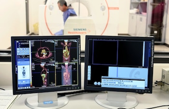 Más de cuatro mil estudios diagnósticos han sido realizados en el Ciclotrón PET/CT, de los cuales tres mil corresponden a pacientes con cáncer. Crédito: UCR