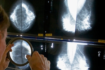 El estudio vincula la mayor