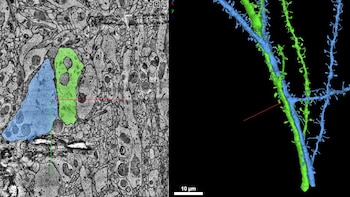 Mapa cerebral Google Harvard