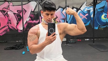 Hernerl de Sosa: de las tarimas a perder una parte de su cuerpo, la historia de superación que cambió su vida