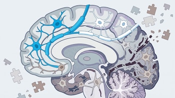 Las células que protegen el cerebro pueden acelerar el deterioro cognitivo en la vejez, de acuerdo con un estudio