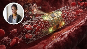 La oncóloga que diseñó un stent para frenar el cáncer: “¿Y si pudiéramos detener la enfermedad en la primera célula?”
