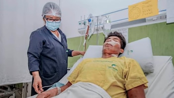 Un hombre vivió más de 10 años con un tumor de 15 centímetros en el rostro y se lo extirparon con planificación 3D