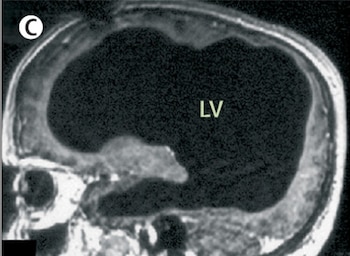 Escáner de la cabeza con