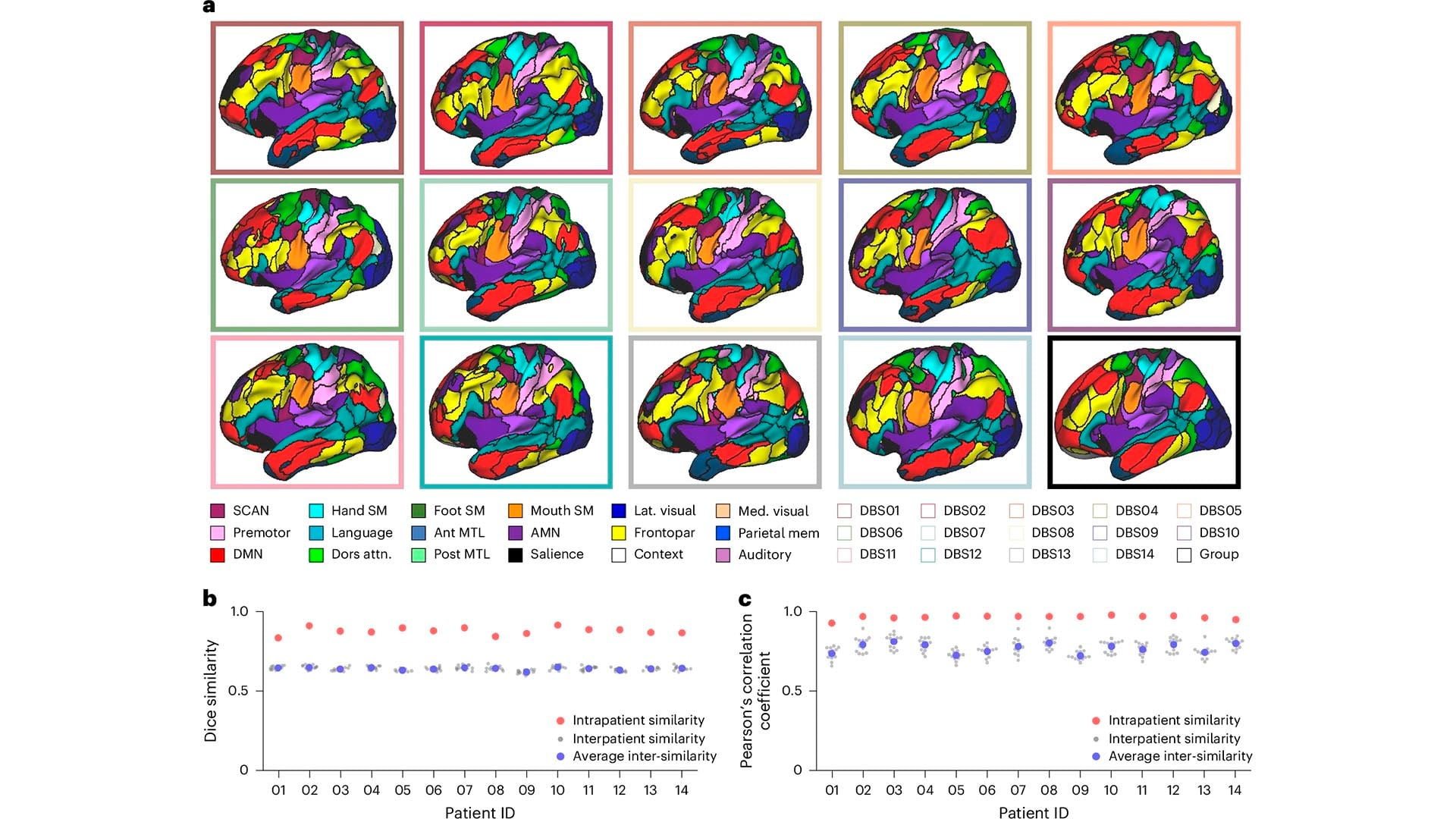 Utilizando resonancias magnéticas de alta resolución, los investigadores analizaron los cambios en la conectividad cerebral provocados por la estimulación (Nature Neuroscience)
