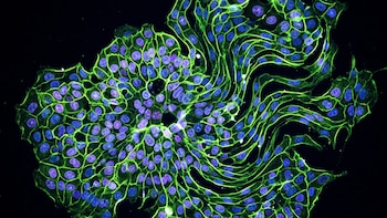 Imagen microscópica de células. Fondo negro. Núcleos ovalados en tonos azules y violetas. Red filamentosa verde que conecta las células