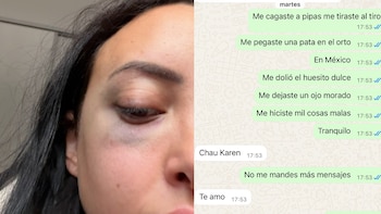 La novia de un ex futbolista de Boca lo acusó por violencia de género