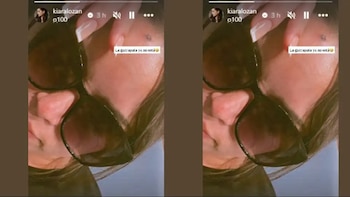 Kiara Lozano revela cómo luce tras eliminar un lunar de su frente