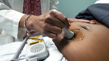 Primer plano de un profesional médico realizando un ultrasonido en el abdomen de una persona embarazada, con gel de ecografía visible y un dispositivo de doppler fetal