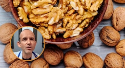 Óscar Rosero, médico endocrino: “Siempre le digo a mis pacientes que tomen estos tres alimentos porque funcionan muy bien para cuidar el corazón”