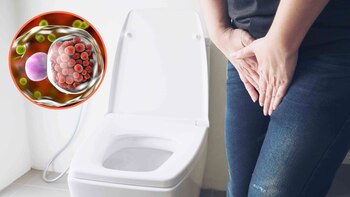 Foto composición: Infobae Perú.