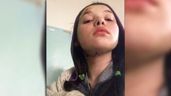 Kira Obedinsky, herida, habla con