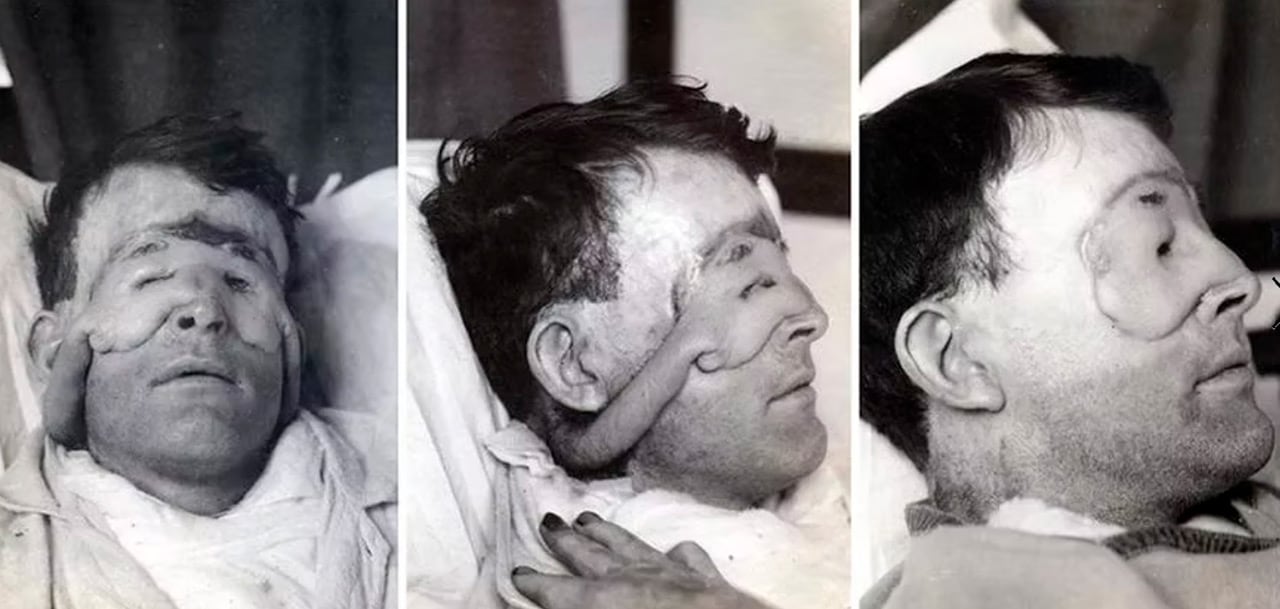 Las fotografías de su caso se convirtieron, un siglo más tarde, en algunas de las imágenes médicas más compartidas de internet