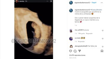 Ecografía de Greeicy Rendón