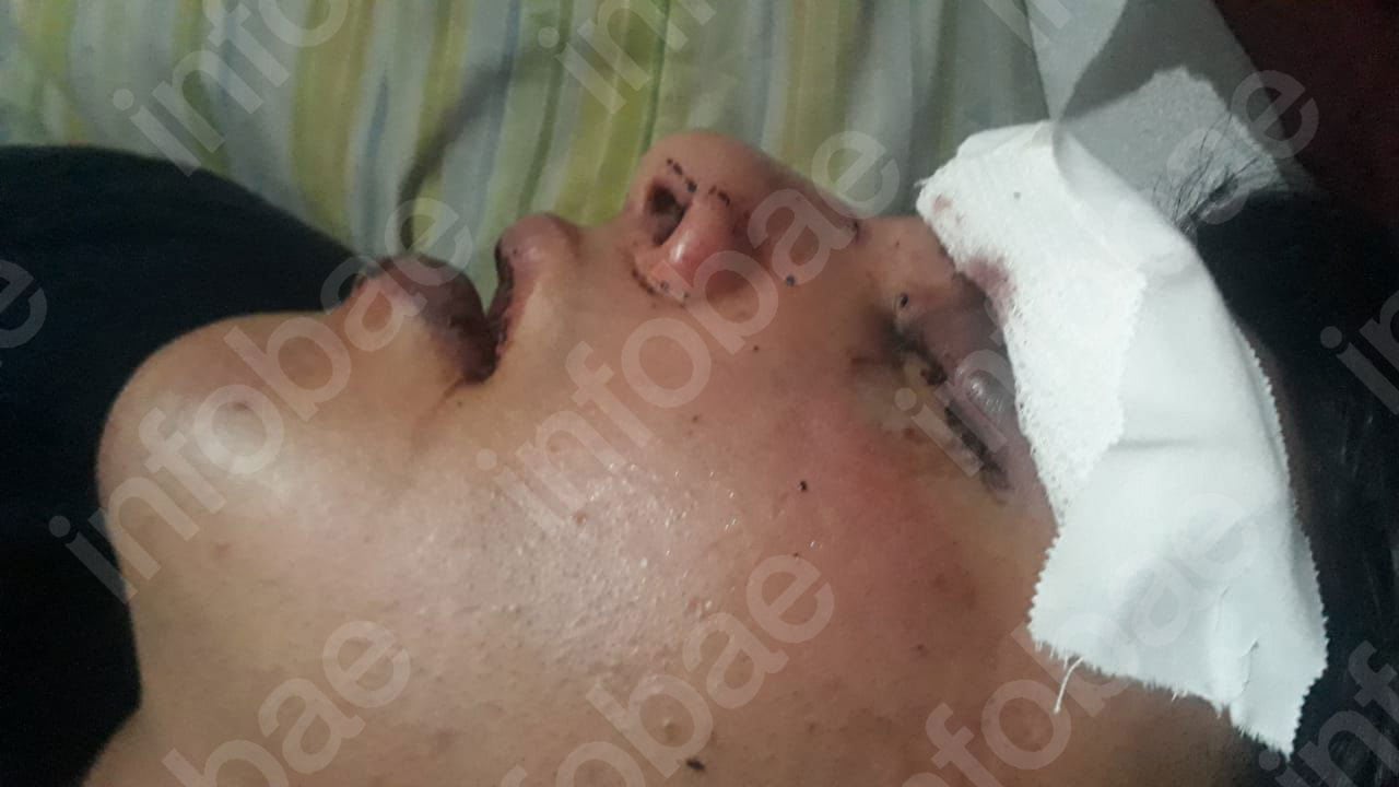 Así quedó el rostro del joven. Las primeras versiones sostienen que cayó al vacío, pero la familia denunció que fue agredido por patovicas