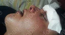 “Se ahogaba con su sangre”, el crudo relato de la novia del joven que denunció una agresión en un boliche de San Telmo