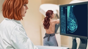 “El 90% de los casos de cáncer de mama se pueden curar”: cuáles son los estudios para detectar a tiempo