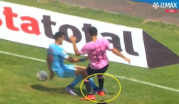 El pisotón de Agustín Gómez sobre el pie derecho de Emilio Saba y el penal a favor de Sport Boys ante Deportivo Garcilaso.