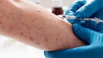 México supera los 12 mil