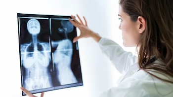 La detección precoz es clave