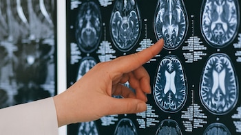 El término electroencefalografista está vinculado