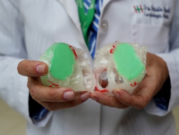 Dos manos en bata médica sostienen dos secciones transparentes con centro verde y líneas rojas