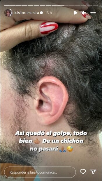 El influencer recibió un golpe