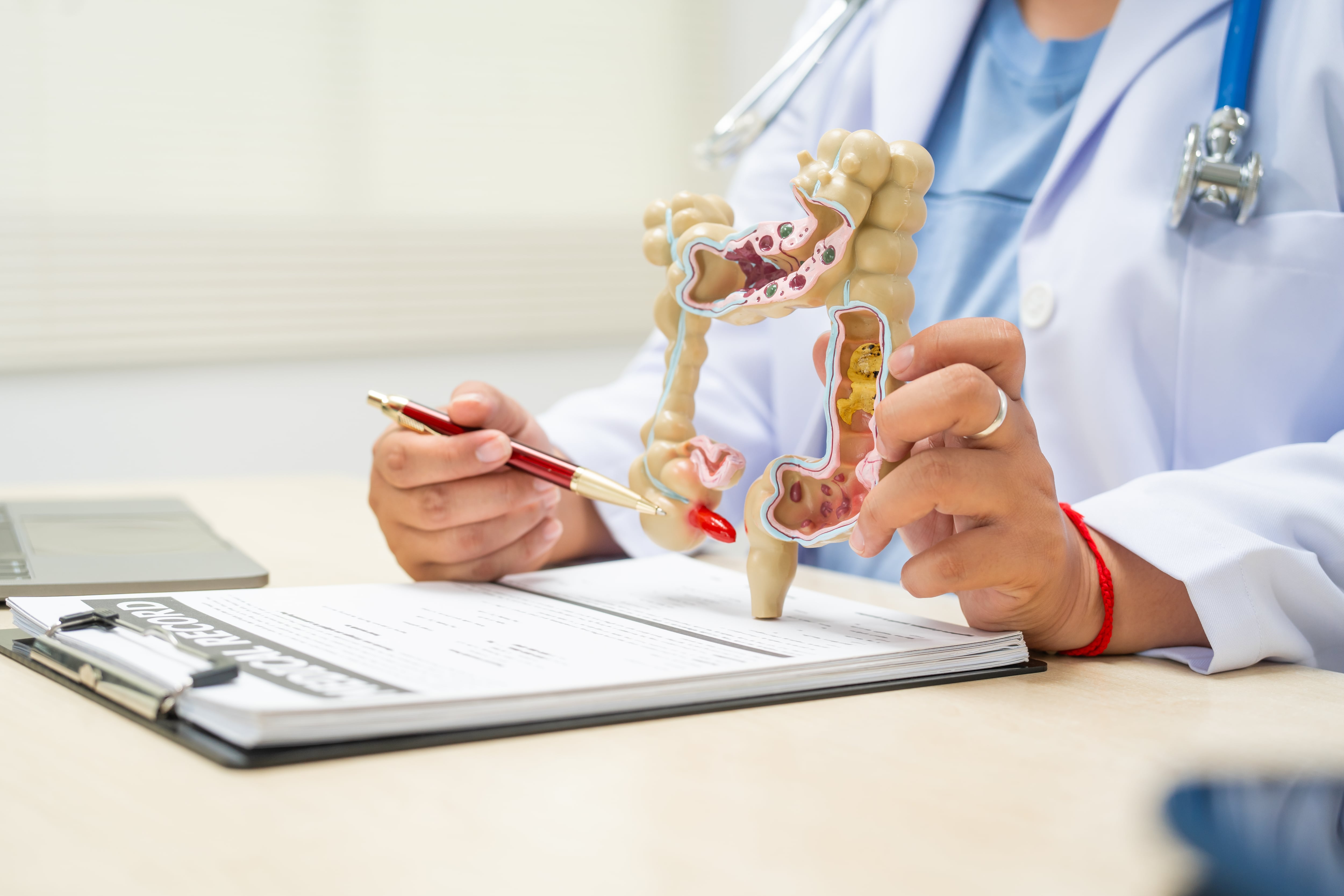 Los casos de cáncer de colon han experimentado un aumento en jóvenes en los últimos años (AdobeStock)