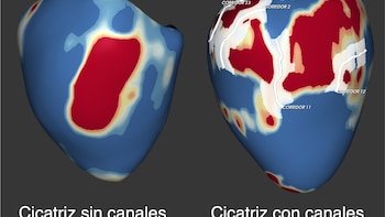 Investigadores españoles logran desarrollar un algoritmo que predice arritmias y previene la muerte súbita
