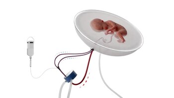 Recreación de cómo podría ser la futura aplicación clínica del proyecto en humanos. (Fundación la Caixa)