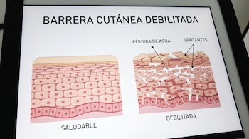 Ilustración de barrera cutánea: una sección saludable y otra debilitada con flechas que señalan pérdida de agua e irritantes.