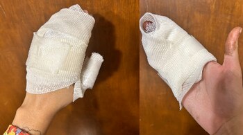 Manos vendadas, daños por líquido