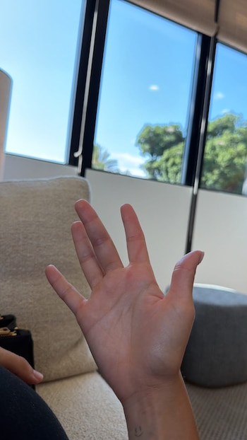 Aitana se rompe un dedo antes del concierto de Zaragoza (WhatsApp)