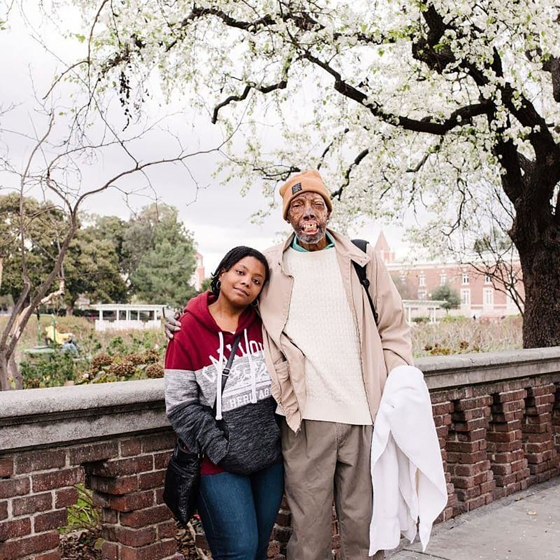 Robert Chelsea, primer afroamericano en recibir un trasplante facial, lucha a diario con el estigma socia.l y las secuelas médicas de la operación (Foto: IG @robertlchelsea88)