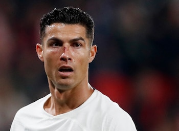 Cristiano se quitó los apósitos