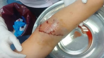 La mujer fue derribada en la vía pública y trasladada al hospital local, donde el personal médico realizó curaciones y suturas internas y externas