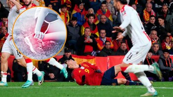 Lesión en el mundo del