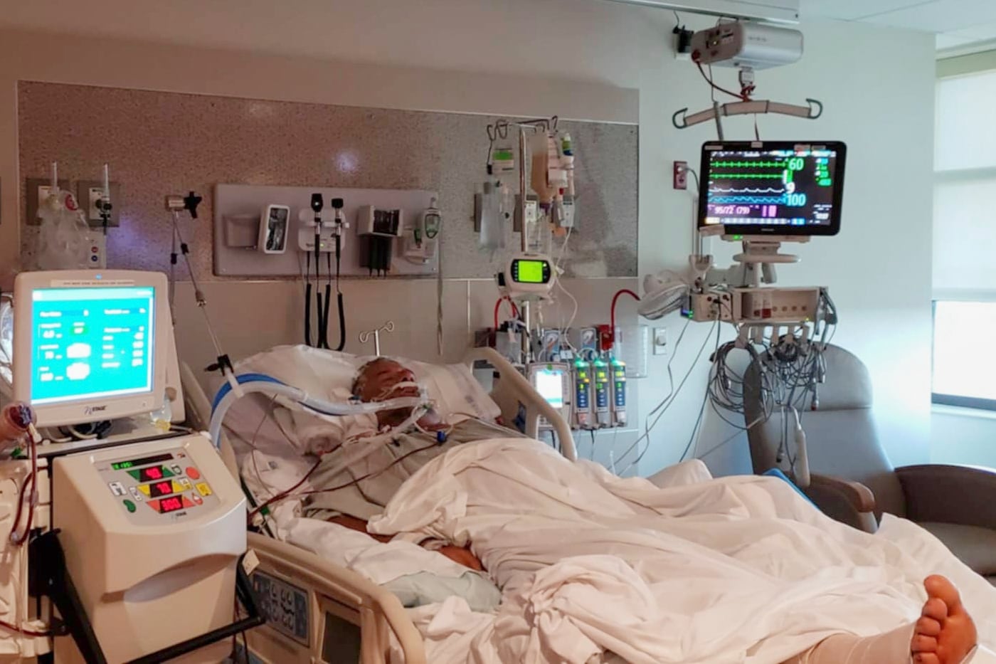 Las infecciones por V. vulnificus pueden evolucionar rápidamente, generando lesiones graves en la piel y poniendo en riesgo la vida de personas vulnerables (Karrianne Stewart vía AP)