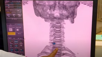 Asalto a escolar: joven podría