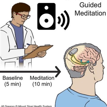 Gráfico que muestra la configuración
